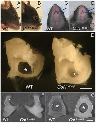 Csf1 Signaling Regulates Maintenance of Resident Macrophages and Bone Formation in the Mouse Cochlea